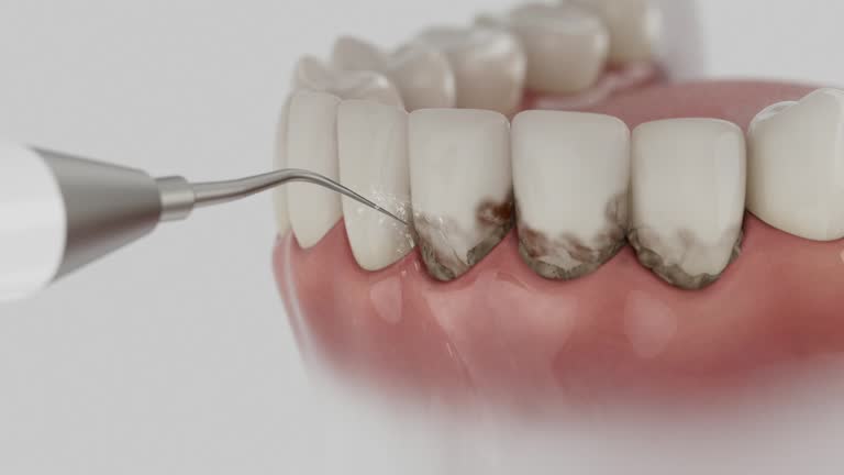 Trusted Dental Implants service in Harveys Lake, PA - Dentist Open Now